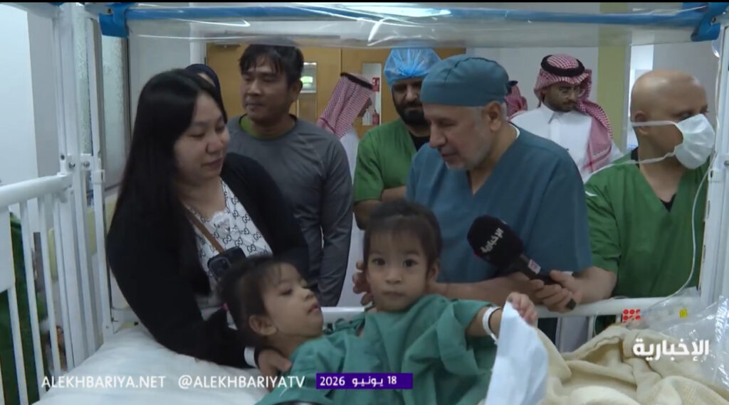 بتوجيهات القيادة.. انطلاق عملية فصل التوأم الملتصق الفلبيني «أوليفيا وجيانا» في الرياض بمشاركة 22 مختصًا